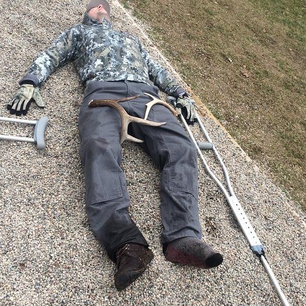 Deer hunter on crutches after a long day of shed hunting